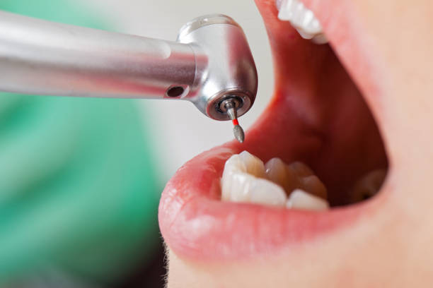 Best Broken or Cracked Tooth Emergency Dentist in Sunland Park, NM
